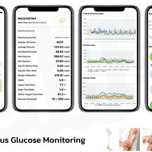 CGM CT10 | ตรวจน้ำตาลอย่างแบบต่อเนื่อง10 วันผ่าน Bluetooth ติดตั้งได้เอง