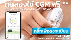 Read more about the article ทดลองใช้เครื่อง CGM ฟรี* วัดน้ำตาลในเลือดต่อเนื่อง 10-15วัน