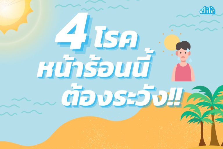 Read more about the article เตือน 4 โรคหน้าร้อนที่ควรระวัง