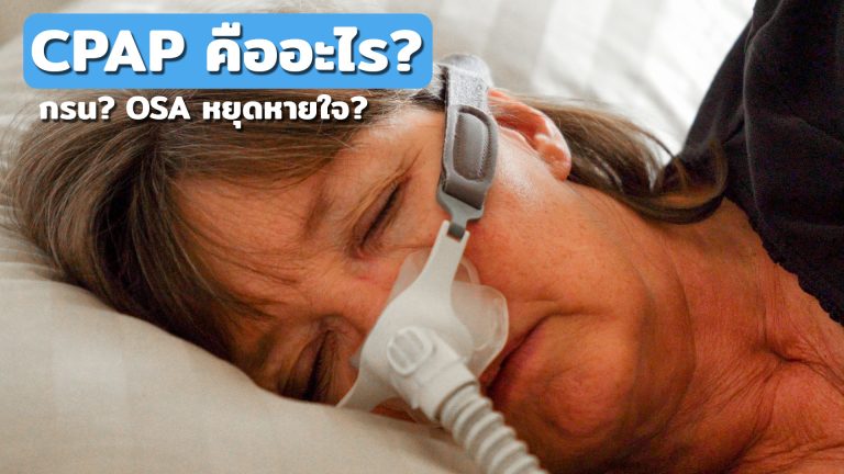 Read more about the article CPAP คืออะไร? / รักษานอนกรน OSA หยุดหายใจ?