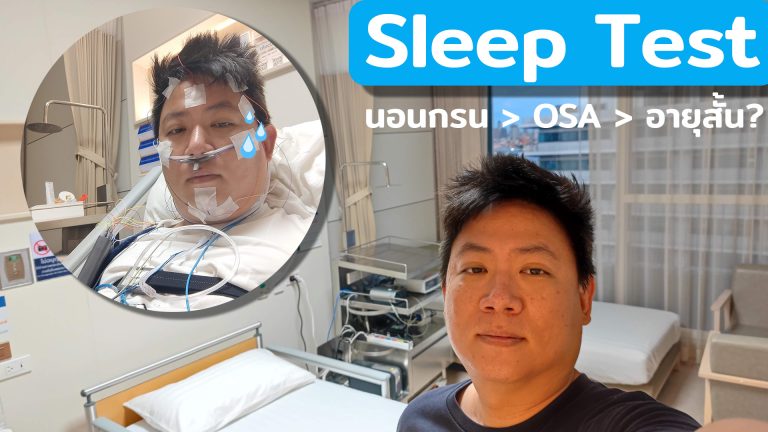 Read more about the article แชร์ปสก. Sleep Test คิดว่าแค่นอนกรน เจออาการ OSA หยุดหายใจรุนแรง ต้องการรักษา ไม่อยากอายุสั้น