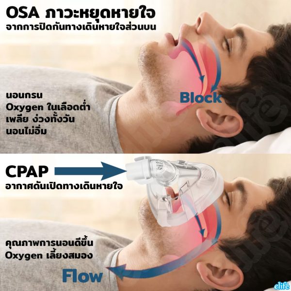 Yuwell YH-450 | CPAP สุดคุ้มเต็มฟังก์ชั่นเชตพร้อม Heated Tube + Wifi/BT + SPO2 + Mask (ประกันศูนย์2ปี) - Image 2
