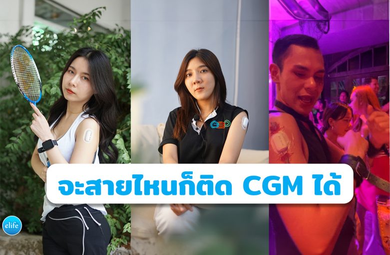 สายไหนก็ติด CGM ได้