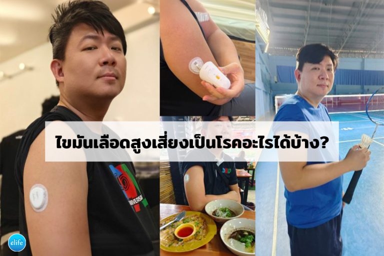 Read more about the article ไขมันเลือดสูงเสี่ยงเป็นโรคอะไรได้บ้าง?