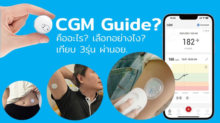 Read more about the article CGM 3รุ่น วัดน้ำตาล ไม่ต้องเจาะปลายนิ้ว ผ่านอย.ไทยแล้ว(2024)