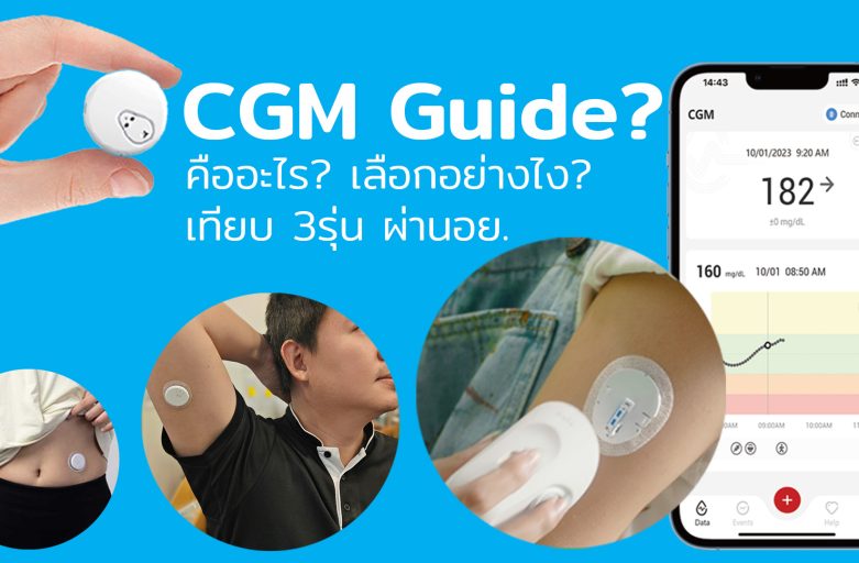 CGM 3รุ่น วัดน้ำตาล ไม่ต้องเจาะปลายนิ้ว ผ่านอย.ไทยแล้ว(2024)