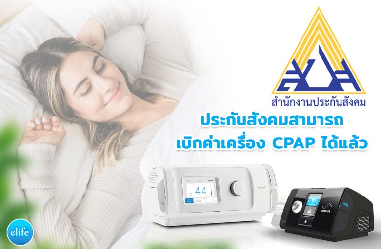 รู้หรือไม่ ประกันสังคมสามารถเบิกค่าเครื่อง CPAP ได้แล้ว