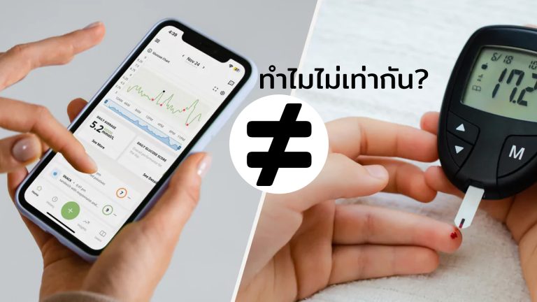 Read more about the article ทำไมน้ำตาลไม่เท่ากัน เจาะปลายนิ้ว vs CGM?