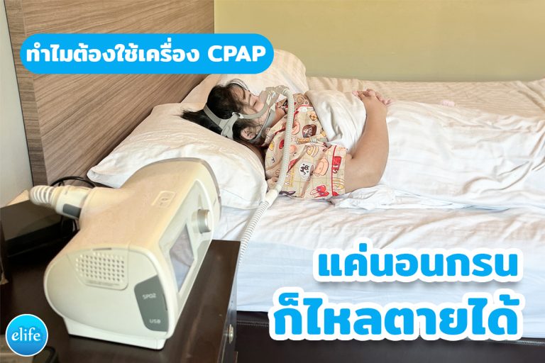 Read more about the article ทำไมเครื่อง CPAP ถึงสำคัญ?