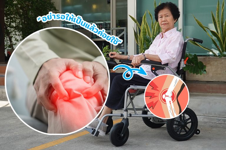 Read more about the article ข้อเข่าเสื่อม ความเจ็บปวดตัวร้าย ต่อการใช้ชีวิต