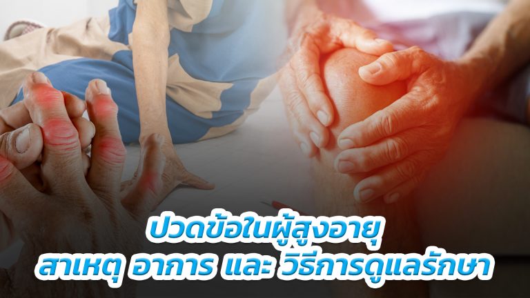 Read more about the article ปวดข้อในผู้สูงอายุ: สาเหตุ อาการ และวิธีการดูแลรักษา