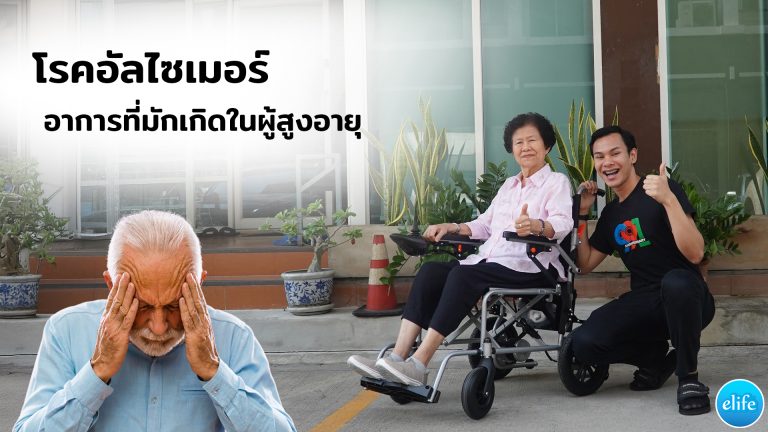 Read more about the article โรคอัลไซเมอร์  ขี้หลง ขี้ลืม อาการที่มักเกิดในผู้สูงอายุ