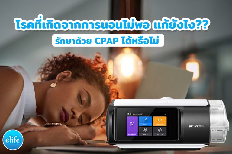 Read more about the article โรคที่เกิดจากการนอนไม่พอ และการแก้ไขด้วยเครื่อง CPAP ได้หรือไม่