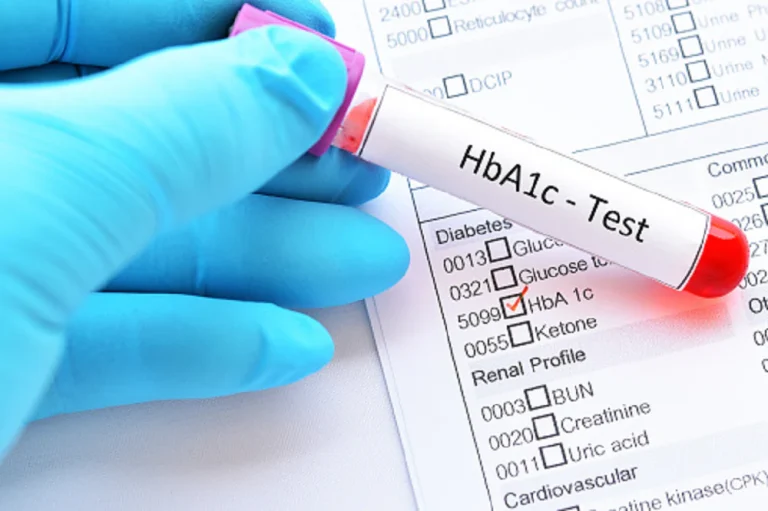 Read more about the article HbA1c คืออะไร สำคัญอย่างไร เท่าไหร่จึงอันตราย?