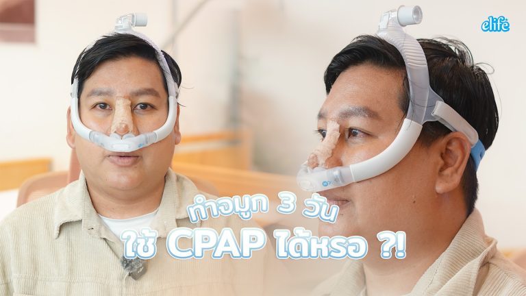 Read more about the article รีวิวทำจมูก 3 วัน ใช้เครื่อง CPAP ได้จริงหรอ ??