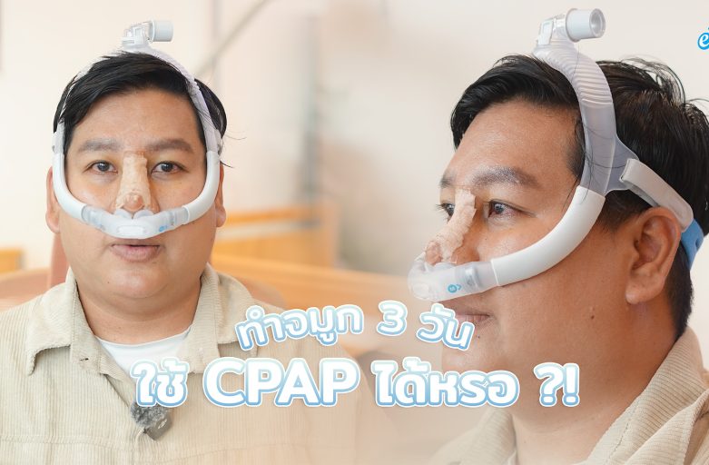 รีวิวทำจมูก 3 วัน ใช้เครื่อง CPAP ได้จริงหรอ ??