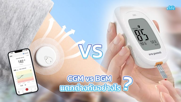 Read more about the article CGM vs BGM แตกต่างกันอย่างไร