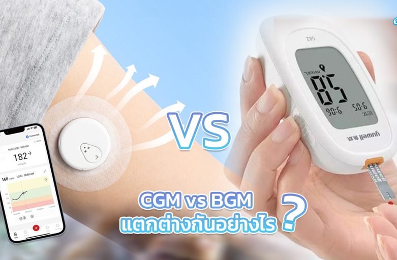 CGM vs BGM แตกต่างกันอย่างไร
