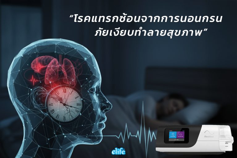 Read more about the article โรคแทรกซ้อนจากการนอนกรน ภัยเงียบที่อาจทำลายสุขภาพ โดยไม่รู้ตัว…
