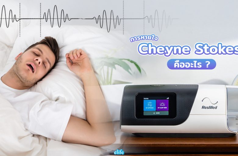 การหายใจแบบ Cheyne Stokes คืออะไร ?