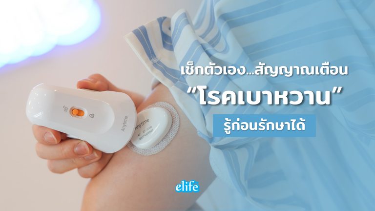Read more about the article เช็กตัวเอง สัญญาณเตือน…โรคเบาหวาน รู้ก่อนรักษาได้