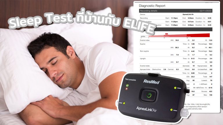 Read more about the article Sleep Test ที่บ้านกับ ELIFE ตรวจการนอนหลับง่าย ๆ เพื่อสุขภาพที่ดีขึ้น