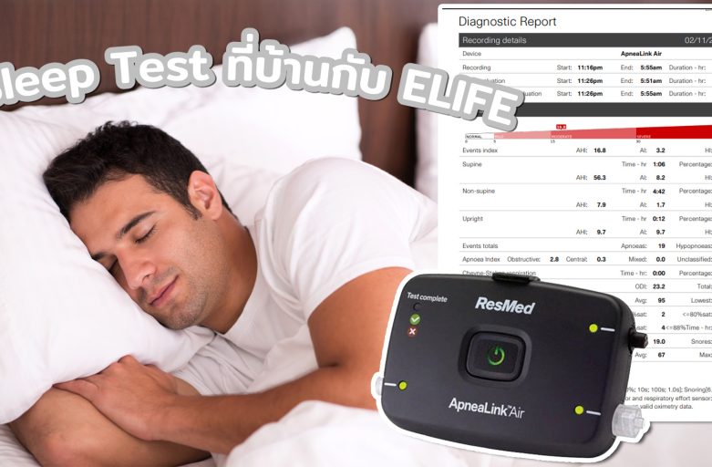 Sleep Test ที่บ้านกับ ELIFE ตรวจการนอนหลับง่าย ๆ เพื่อสุขภาพที่ดีขึ้น Sleep Test ที่บ้านกับ ELIFE ตรวจการนอนหลับง่าย ๆ เพื่อสุขภาพที่ดีขึ้น