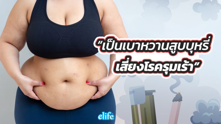 Read more about the article รู้ไหม? เป็นเบาหวานสูบบุหรี่-บุหรี่ไฟฟ้า เสี่ยงโรครุมเร้า พังทั้งร่าง