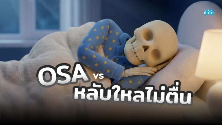 Read more about the article OSA vs หลับใหลไม่ตื่น ?? ต่างกันอย่างไร