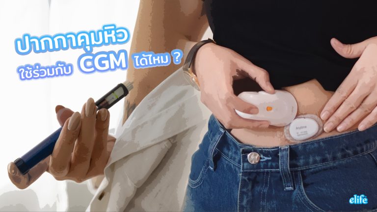Read more about the article ปากกาคุมหิว ใช้ร่วมกับ CGM ได้ไหม?
