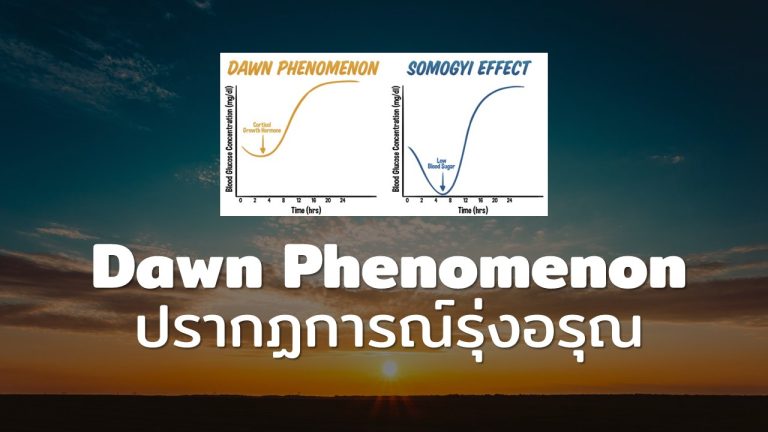 Read more about the article ปรากฏการณ์รุ่งอรุณ ทำไมน้ำตาลในเลือดถึงสูงในตอนเช้า?