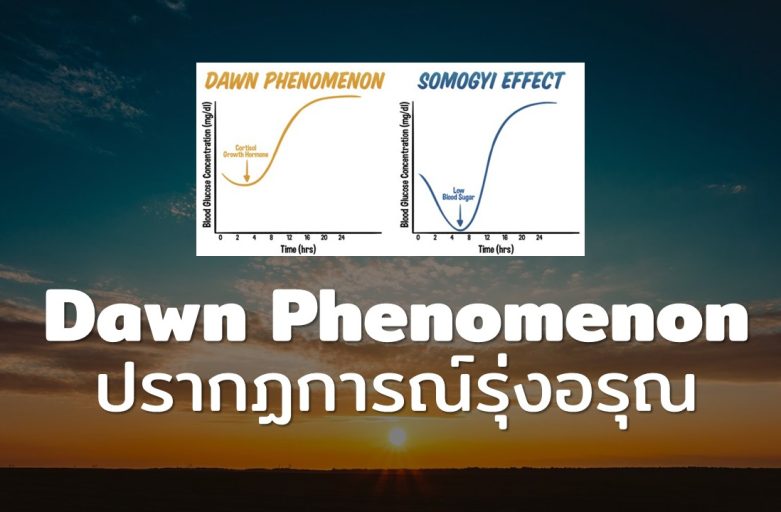 ปรากฏการณ์รุ่งอรุณ ทำไมน้ำตาลในเลือดถึงสูงในตอนเช้า?