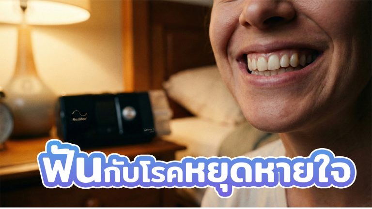 Read more about the article ฟันกับโรคหยุดหายใจขณะหลับ (Sleep Apnea) เกี่ยวข้องกันอย่างไร