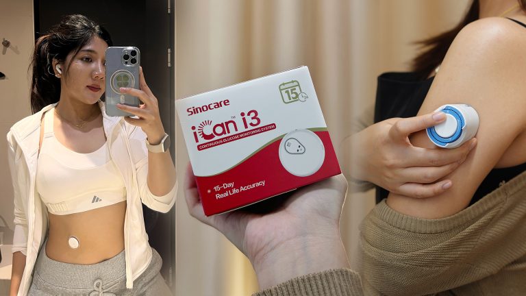 Read more about the article iCan i3 CGM กล้องวงจรปิดน้ำตาล ที่ราคาเฉลี่ยตกชั่วโมงละ 4 บาท !