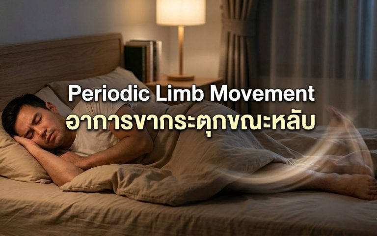 Read more about the article Periodic Limb Movement อาการขากระตุกขณะหลับ เมื่อร่างกายไม่ยอมหลับไปพร้อมกับคุณ