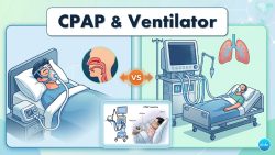 Read more about the article เครื่องช่วยหายใจ (Ventilator) เหมือนหรือแตกต่าง กับเครื่อง CPAP อย่างไร?