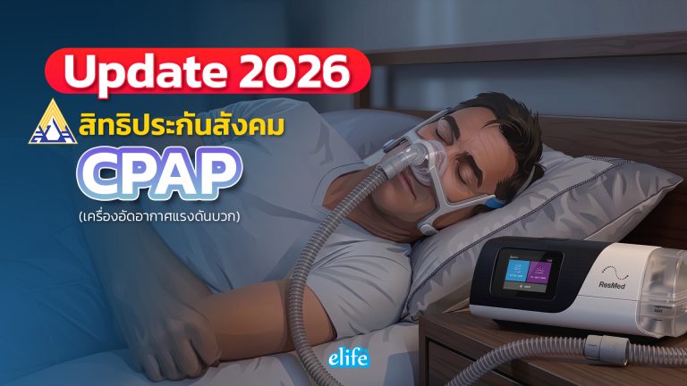 Read more about the article อัปเดตใหม่2026 เงื่อนไขการเบิกเครื่อง CPAP ผ่านสิทธิประกันสังคม เปลี่ยนแปลงอะไรบ้าง?