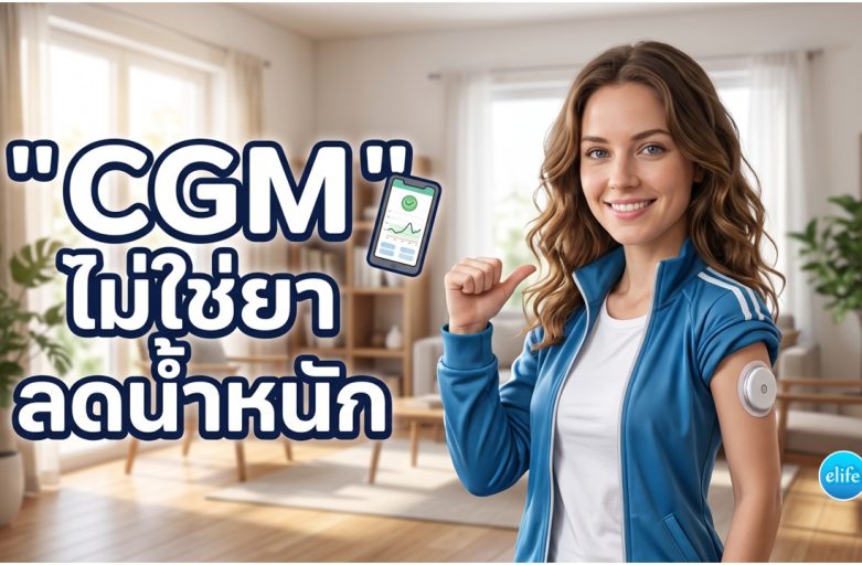 cgm