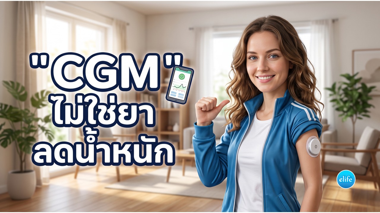 cgm