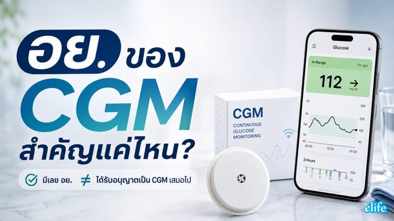 Read more about the article อย.ของ CGM สำคัญแค่ไหน?