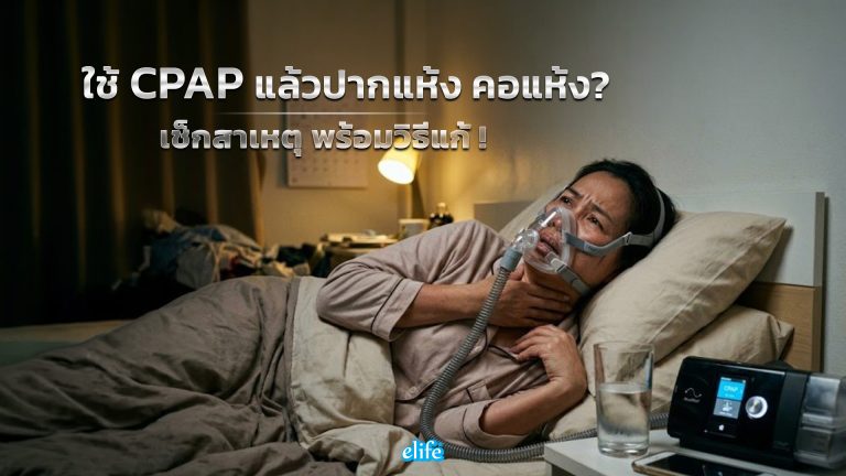 Read more about the article ใช้ CPAP แล้วปากแห้ง คอแห้งมาก มาเช็ควิธีแก้ไขกัน