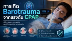 Read more about the article การเกิด Barotrauma จากแรงดัน CPAP