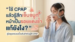 Read more about the article ใช้ CPAP แล้วเจ็บจมูก หน้าเป็นรอยแดงช้ำ แก้ยังไง?