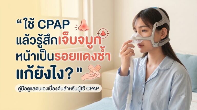 Read more about the article ใช้ CPAP แล้วเจ็บจมูก หน้าเป็นรอยแดงช้ำ แก้ยังไง?