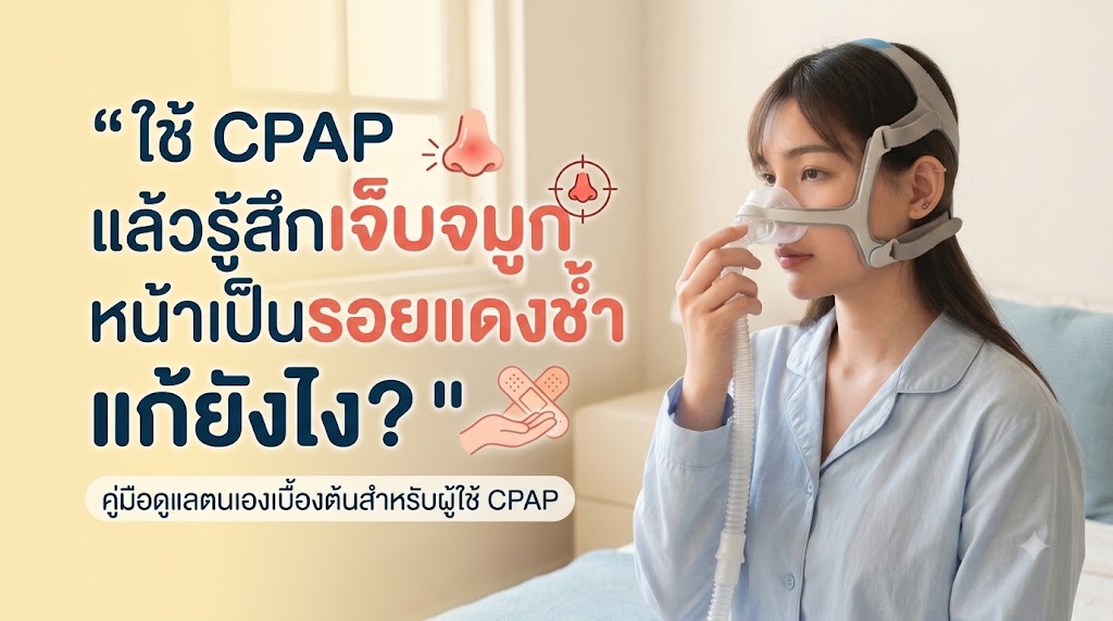 You are currently viewing ใช้ CPAP แล้วเจ็บจมูก หน้าเป็นรอยแดงช้ำ แก้ยังไง?
