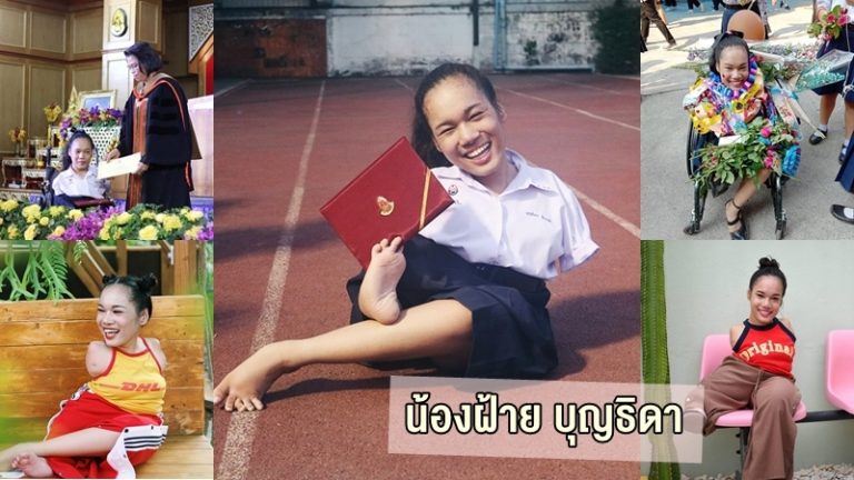 Read more about the article ปรับแต่งรถเข็นไฟฟ้า ให้ผู้พิการไม่มีแขน ด้วยเครื่องพิมพ์ 3มิติ