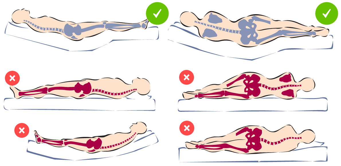 ลักษณะแนวกระดูกที่ถูกต้องขณะนอน