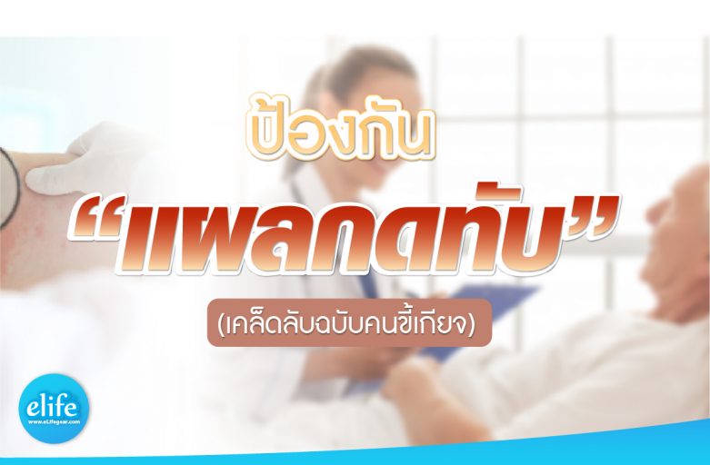 ป้องกันแผลกดทับ ฉบับคนขี้เกียจ